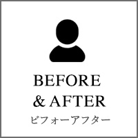 新宿で太もも痩せならダイエットウーマンのBEFORE&AFTER VOICE ビフォーアフター